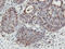 N-Myristoyltransferase 2 antibody, LS-C173672, Lifespan Biosciences, Immunohistochemistry paraffin image 