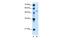 Pregnancy Specific Beta-1-Glycoprotein 1 antibody, GTX47046, GeneTex, Western Blot image 