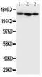 Collagen Type IV Alpha 1 Chain antibody, PA1536, Boster Biological Technology, Western Blot image 