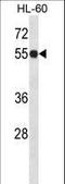 Inosine Monophosphate Dehydrogenase 1 antibody, LS-B11005, Lifespan Biosciences, Western Blot image 