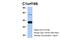 Mitochondrial E3 Ubiquitin Protein Ligase 1 antibody, 25-848, ProSci, Western Blot image 