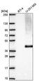 Solute Carrier Family 16 Member 1 antibody, PA5-67140, Invitrogen Antibodies, Western Blot image 