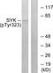 Spleen Associated Tyrosine Kinase antibody, PA5-38335, Invitrogen Antibodies, Western Blot image 