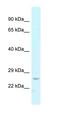 Cytidine/Uridine Monophosphate Kinase 1 antibody, orb326402, Biorbyt, Western Blot image 