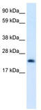 High Mobility Group Box 3 antibody, TA339107, Origene, Western Blot image 