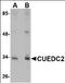 CUE Domain Containing 2 antibody, orb89200, Biorbyt, Western Blot image 