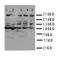 ATM Serine/Threonine Kinase antibody, LS-C312932, Lifespan Biosciences, Western Blot image 