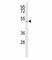 Solute Carrier Family 16 Member 1 antibody, F48178-0.4ML, NSJ Bioreagents, Western Blot image 