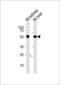 Casein Kinase 1 Gamma 3 antibody, LS-C164356, Lifespan Biosciences, Western Blot image 