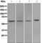 NADPH Oxidase 4 antibody, ab109225, Abcam, Western Blot image 