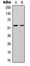 Potassium Two Pore Domain Channel Subfamily K Member 3 antibody, LS-C368601, Lifespan Biosciences, Western Blot image 