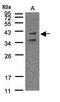 Purinergic Receptor P2Y11 antibody, GTX108241, GeneTex, Western Blot image 