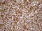 Interferon Induced Transmembrane Protein 2 antibody, M04964, Boster Biological Technology, Immunohistochemistry paraffin image 