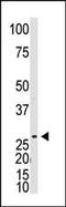 Dickkopf Like Acrosomal Protein 1 antibody, PA5-11623, Invitrogen Antibodies, Western Blot image 