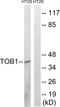 Transducer Of ERBB2, 1 antibody, LS-C118378, Lifespan Biosciences, Western Blot image 