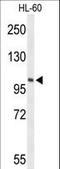 Lipase E, Hormone Sensitive Type antibody, LS-C165793, Lifespan Biosciences, Western Blot image 