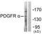 Platelet Derived Growth Factor Receptor Alpha antibody, TA312820, Origene, Western Blot image 
