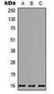 Potassium Voltage-Gated Channel Subfamily J Member 15 antibody, orb234889, Biorbyt, Western Blot image 