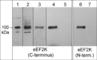 Eukaryotic Elongation Factor 2 Kinase antibody, EP4661, ECM Biosciences, Western Blot image 