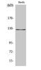 MutS Homolog 3 antibody, STJ94262, St John