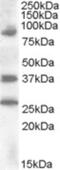 Homeobox D10 antibody, NBP1-28476, Novus Biologicals, Western Blot image 