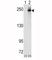 ALK Receptor Tyrosine Kinase antibody, F50550-0.4ML, NSJ Bioreagents, Western Blot image 