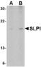 Secretory Leukocyte Peptidase Inhibitor antibody, AHP1437, Bio-Rad (formerly AbD Serotec) , Western Blot image 