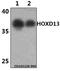 Homeobox D13 antibody, A03000, Boster Biological Technology, Western Blot image 
