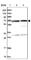 Succinate Dehydrogenase Complex Flavoprotein Subunit A antibody, HPA041981, Atlas Antibodies, Western Blot image 