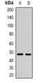 Amylase Alpha 2A (Pancreatic) antibody, LS-C482953, Lifespan Biosciences, Western Blot image 