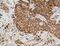 GTP Binding Protein 3, Mitochondrial antibody, 10764-1-AP, Proteintech Group, Immunohistochemistry paraffin image 