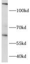 Chaperonin Containing TCP1 Subunit 6B antibody, FNab01402, FineTest, Western Blot image 