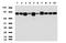 Melanoma Cell Adhesion Molecule antibody, LS-C796880, Lifespan Biosciences, Western Blot image 