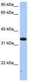 Sulfotransferase Family 6B Member 1 antibody, TA346693, Origene, Western Blot image 