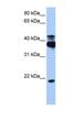 Serine/threonine-protein kinase 38 antibody, NBP1-58362, Novus Biologicals, Western Blot image 