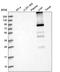 Glycogen Synthase 2 antibody, PA5-58806, Invitrogen Antibodies, Western Blot image 