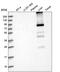 Glycogen [starch] synthase, liver antibody, PA5-58806, Invitrogen Antibodies, Western Blot image 