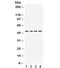 Ribonucleotide Reductase Regulatory Subunit M2 antibody, R32063, NSJ Bioreagents, Western Blot image 