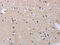 CD33 Molecule antibody, CSB-PA243594, Cusabio, Immunohistochemistry paraffin image 