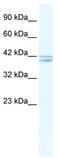 Cholinergic Receptor Nicotinic Alpha 7 Subunit antibody, TA330424, Origene, Western Blot image 