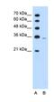 Phosphoribosyl Pyrophosphate Synthetase 2 antibody, orb330190, Biorbyt, Western Blot image 