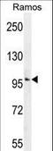 Guanylate Cyclase 2D, Retinal antibody, LS-C166743, Lifespan Biosciences, Western Blot image 