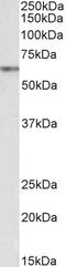 Filamin A antibody, 43-533, ProSci, Western Blot image 