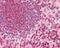 Matrix Metallopeptidase 16 antibody, 49-704, ProSci, Immunohistochemistry paraffin image 