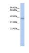 Kelch Domain Containing 8B antibody, NBP1-70591, Novus Biologicals, Western Blot image 
