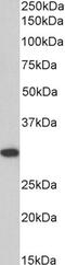 TNF Superfamily Member 13 antibody, 45-272, ProSci, Immunohistochemistry frozen image 