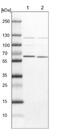 Transcription Factor 25 antibody, NBP1-92211, Novus Biologicals, Western Blot image 