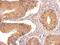 HIV-1 Tat Interactive Protein 2 antibody, GTX100119, GeneTex, Immunohistochemistry paraffin image 