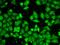 SWI/SNF Related, Matrix Associated, Actin Dependent Regulator Of Chromatin, Subfamily A, Member 5 antibody, orb329561, Biorbyt, Immunofluorescence image 