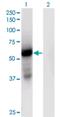 Glutamic--Pyruvic Transaminase 2 antibody, H00084706-M04, Novus Biologicals, Western Blot image 